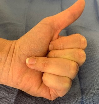 Sport Highlight – Jersey Finger