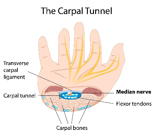 I have had CTR surgery done – What happens now?