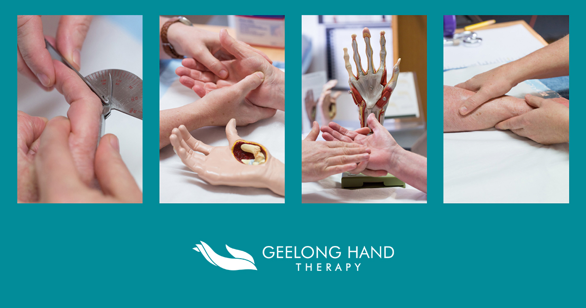 Our Staff | Geelong Hand Therapy