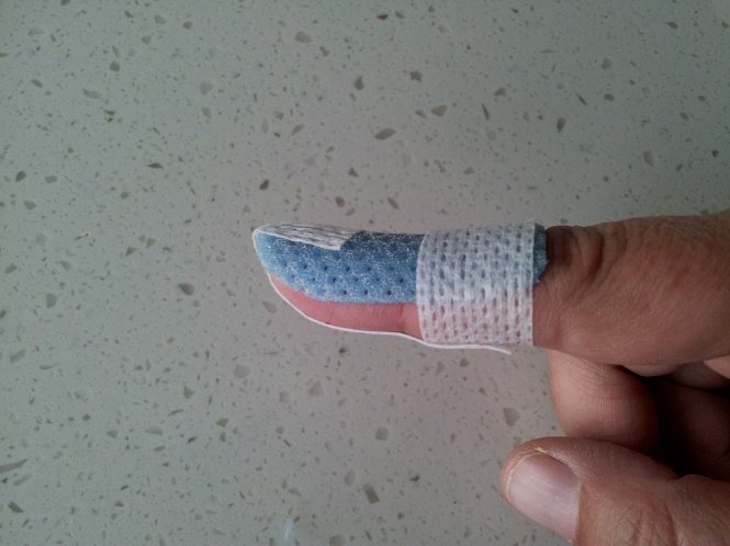 Mallet finger - Why won’t the end of my finger straighten?