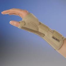 DeQuervain's Tenosynovitis