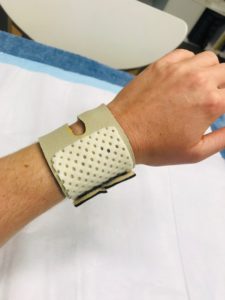 TFCC Injury – Geelong Hand Therapy